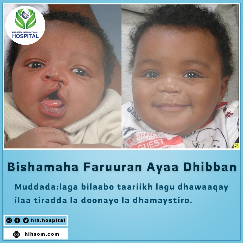 Free medical convoy for cleft lips